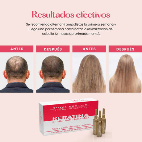 Don Cabello Tratamiento Anticaída Con Keratina – Ampollas Capilares  – 12 Ampollas X 10 Ml - Cosmetics Afro Latino