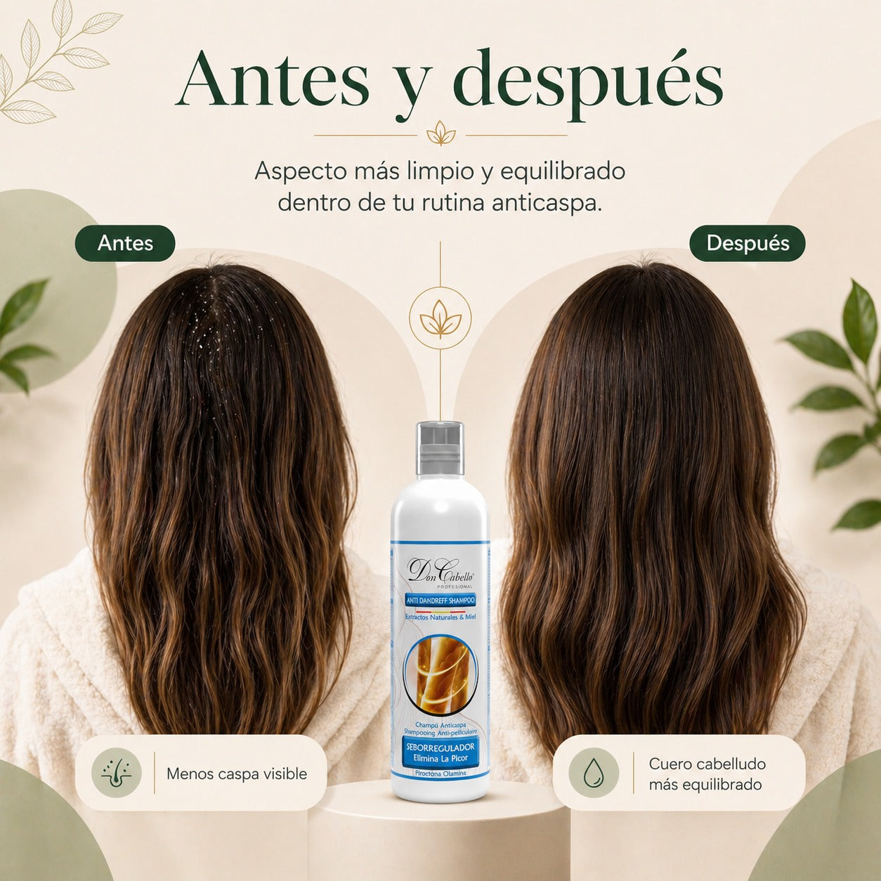 Don Cabello - Champú Anticaspa - 500 Ml